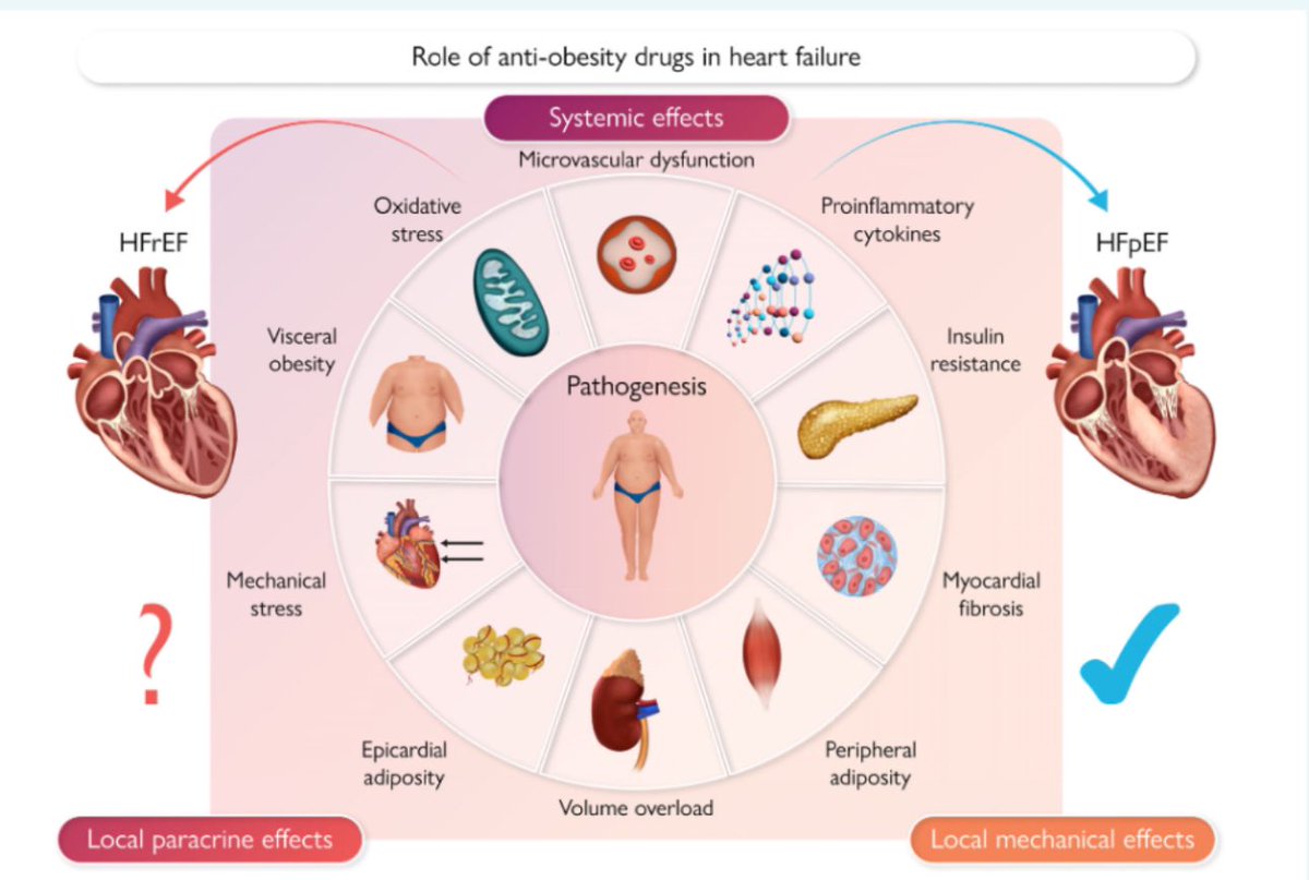 🔴Role of anti-obesity drugs in heart failure regardless of ejection fraction 👉 Pathophysiology of obesity phenotype of heart failure with preserved ejection fraction 📁 onlinelibrary.wiley.com/doi/full/10.10…