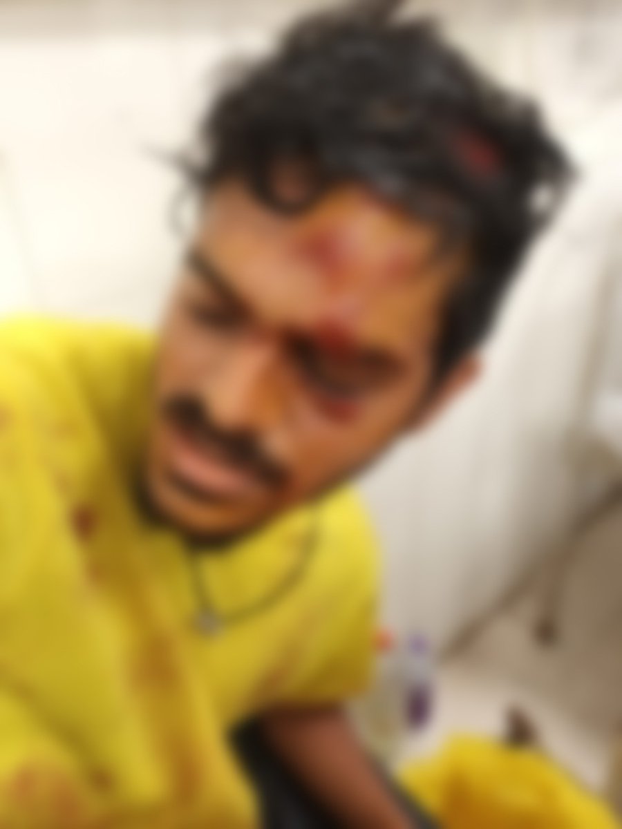This isn't just an assault on women, but an assault on democracy itself. Sensing imminent defeat, YSRCP goons have been on a rampage across the state. In a distressing incident in the 68th ward of Akkireddipalem, two innocent women bore the brunt of this aggression. They were