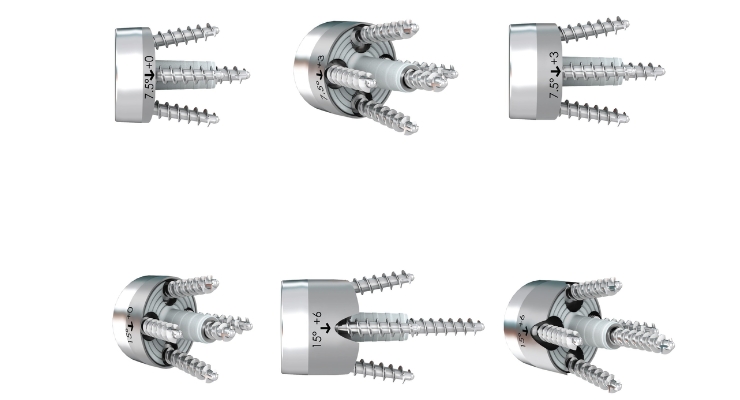 FX Shoulder wins FDA nod for 6 full-wedge, augmented glenoid baseplates: hubs.li/Q02xnZTf0 #shoulderreplacement #shouldersurgery