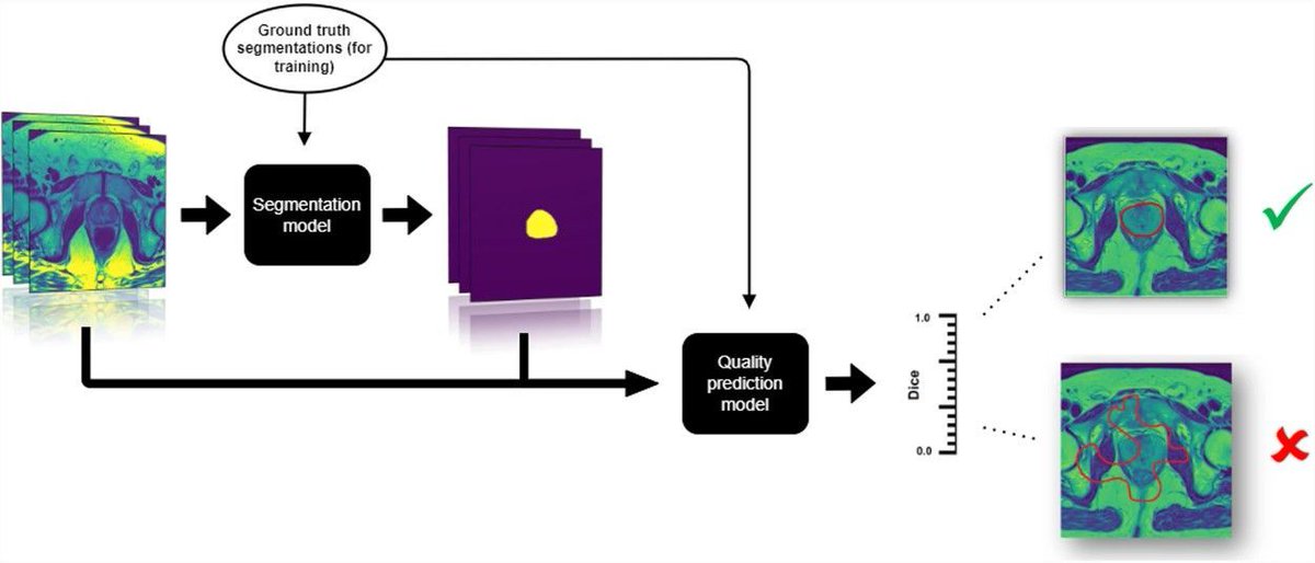 Lars Johannes Isaksson et al. build a #DeepLearning model that estimates the quality of prostate contours, which can be used in practice to ensure quality and monitor the performance of deployed automated contouring models.

#InsightsIntoImaging

🔗 buff.ly/4aaakwu