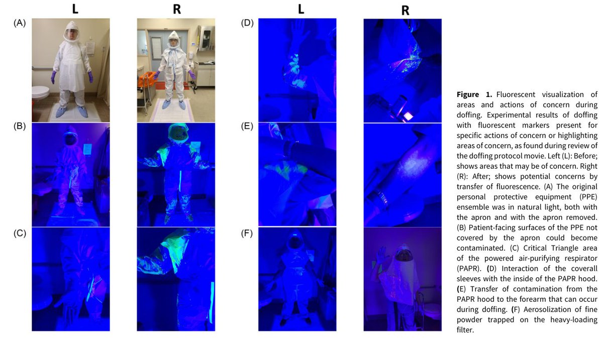 New from @BrandonBerryh, @jaybvarkey, others 🦠Authors use fluorescence and genetically marked bacteriophages to evaluate high-containment PPE doffing ➡️ Updated doffing protocol eliminated the movement of viable bacteriophages from PPE to HCP skin 📄: doi.org/10.1017/ice.20…