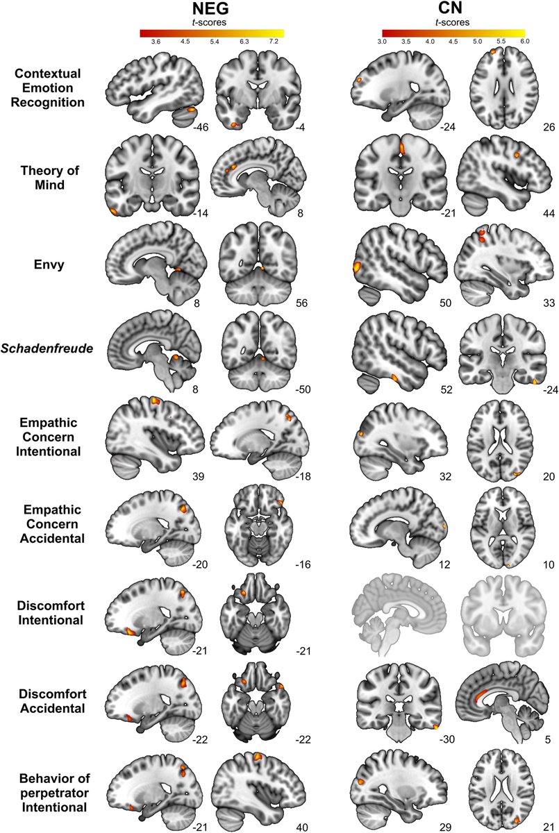 Neglected adolescents exhibit lower performance in prosocial domains (social cognition & emotion tasks), that correlated with critical brain regions. Our work at @NeurobiolStress, led by @CatalinaTLl, Eduar Herrera & @SandraBez9, + co-authors!  👉doi.org/10.1016/j.ynst…