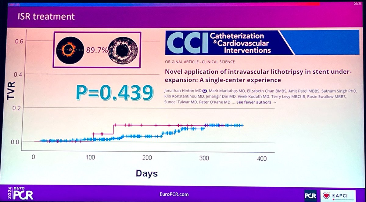 Are you at #EuroPCR ❓

Be sure to check out the data reported by <a href="/DrPeterOKane/">Dr Peter O'Kane</a> &amp; colleagues on the “Novel application of intravascular lithotripsy in stent under-expansion: A single-center experience”

🔗 onlinelibrary.wiley.com/doi/10.1002/cc…