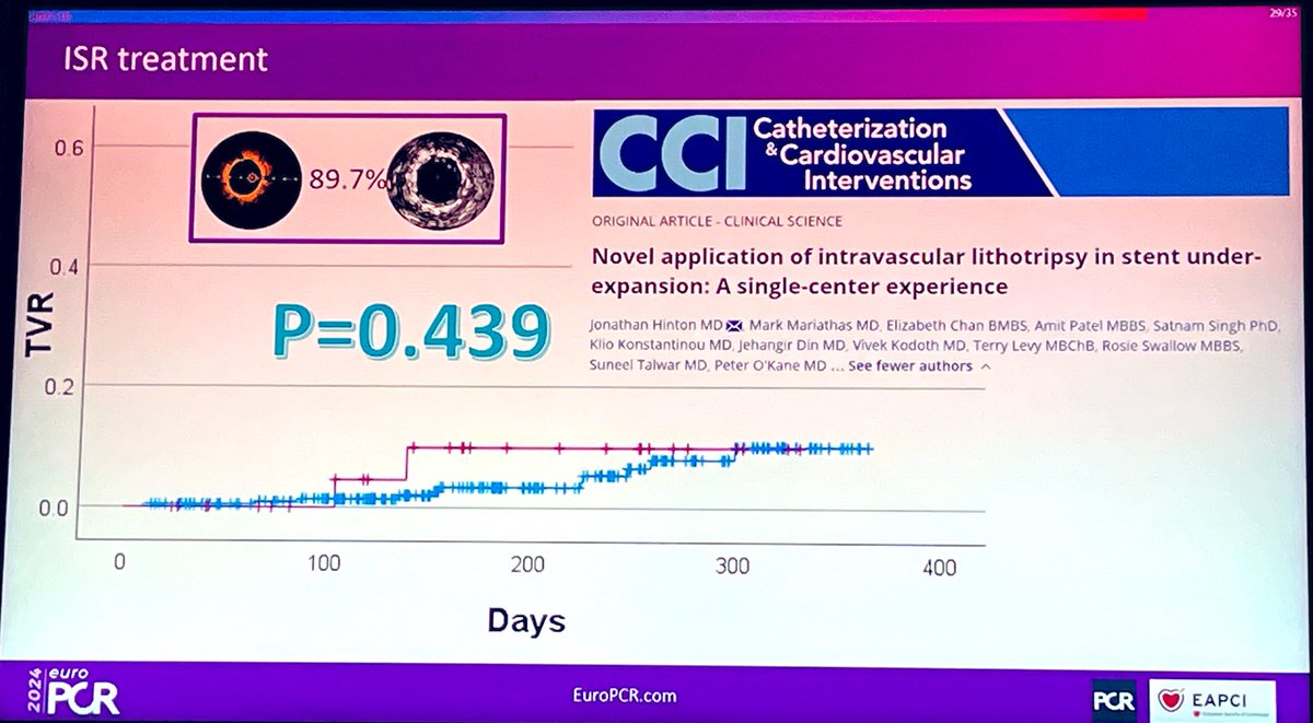 Are you at #EuroPCR ❓ Be sure to check out the data reported by @DrPeterOKane & colleagues on the “Novel application of intravascular lithotripsy in stent under-expansion: A single-center experience” 🔗 onlinelibrary.wiley.com/doi/10.1002/cc…
