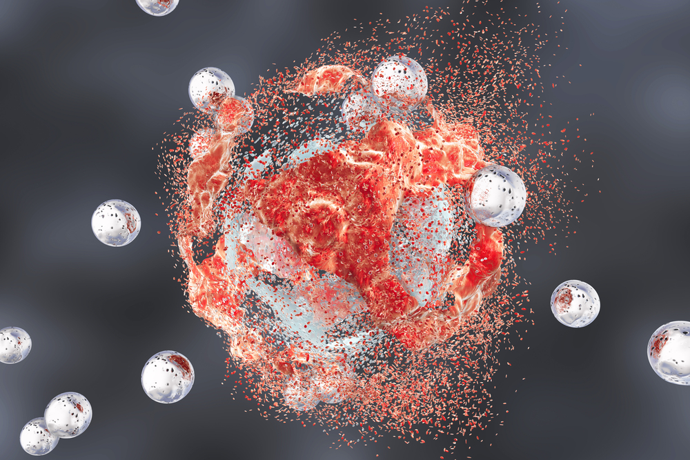 Scientists develop a novel pH-responsive #chitosan #nanoparticle which improves the delivery of #metformin and #glucoseoxidase to #tumor sites and enhances #cancer #celldeath. 

Details in #JournalOfPharmaceuticalAnalysis: ow.ly/bzPw50RHUFv