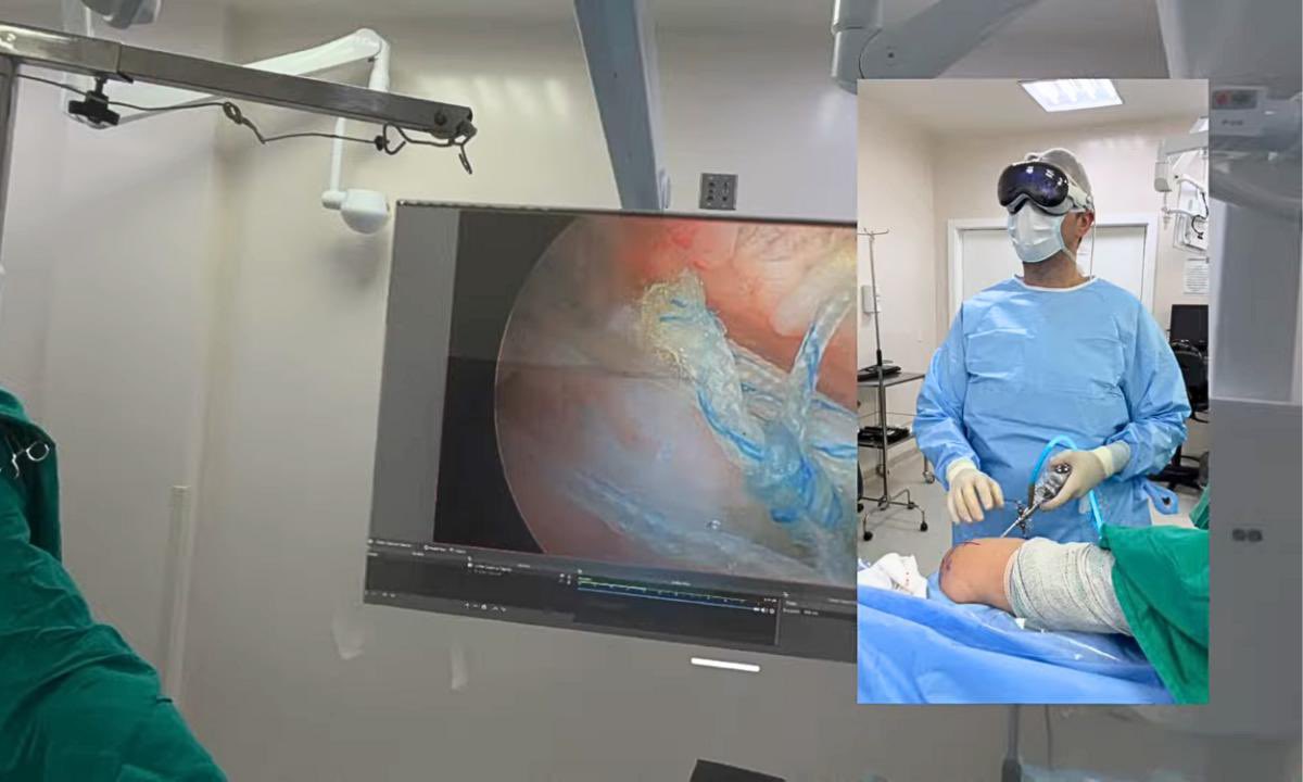 The Apple Vision Pro might not be that appealing to the average user, but it’s definitely very helpful to some working professionals. Doctors in Chennai have already used the Vision Pro while performing 30+ complex surgeries. 
The Vision Pro might just be one of the best