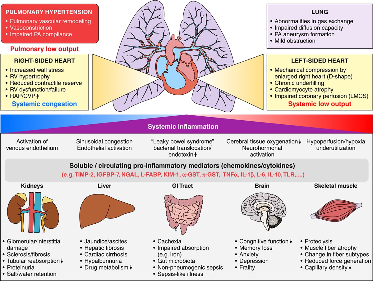 Systemic consequences of pulmonary hypertension and right-sided heart failure: Interdependent mechanisms, systemic inflammation, and interorgan cross-talk. 🔗 ahajournals.org/doi/10.1161/CI… #FOAMed #FOAMcc #POCUS