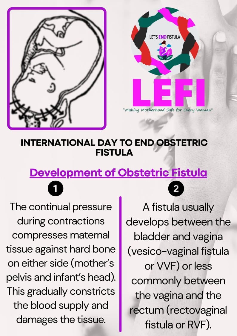 Fistula can be prevented.

When we understand how a woman can develop a #Fistula,  we will be able to take precaution and ensure a safe child birth.

As we look forward to celebrating this year's International Day to End Obstetric Fistula (#IDEOF), 

#IDEOF2024
#EndFistula