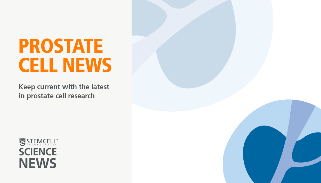 Looking for a one-stop solution to stay on top of all #prostate cell research? Our free, bi-weekly newsletter, Prostate Cell News could be your answer. It delivers the latest prostate cell research right to your inbox. 🖱️ Subscribe now! bit.ly/4cjmXaI