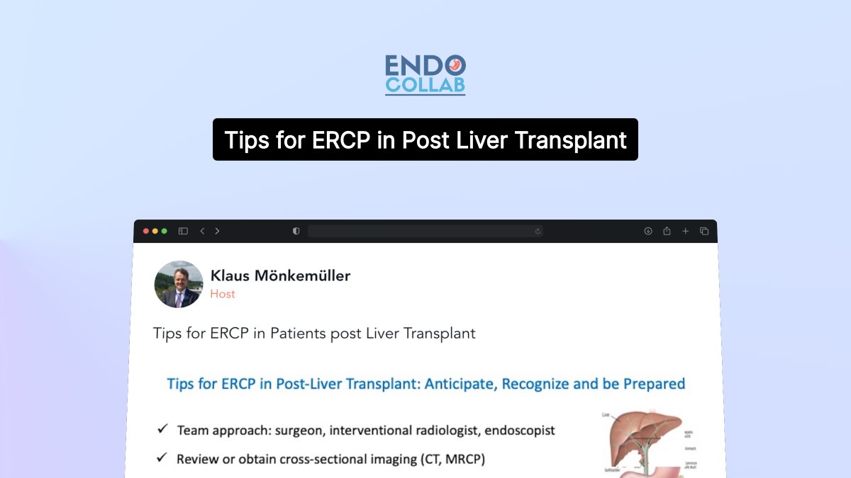 Tips for ERCP in Patients Post Liver Transplant Now on EndoCollab