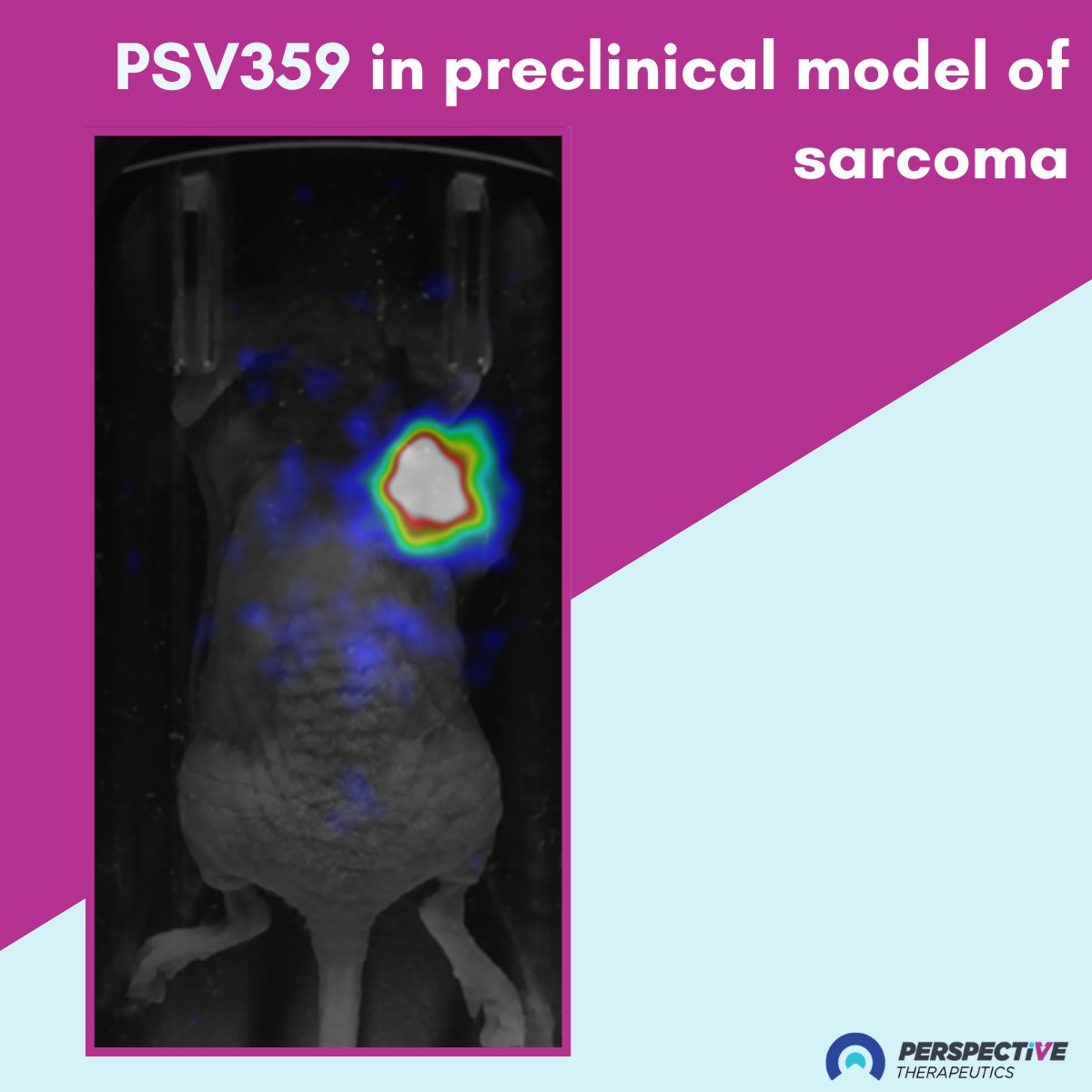 Our in-house discovery team developed peptide PSV359 with potential best-in-class characteristics for targeting FAP. In preclinical models of sarcoma, it showed high uptake and retention, and rapid clearance. 

perspectivetherapeutics.com

#oncology #nuclearmedicine #radiopharma