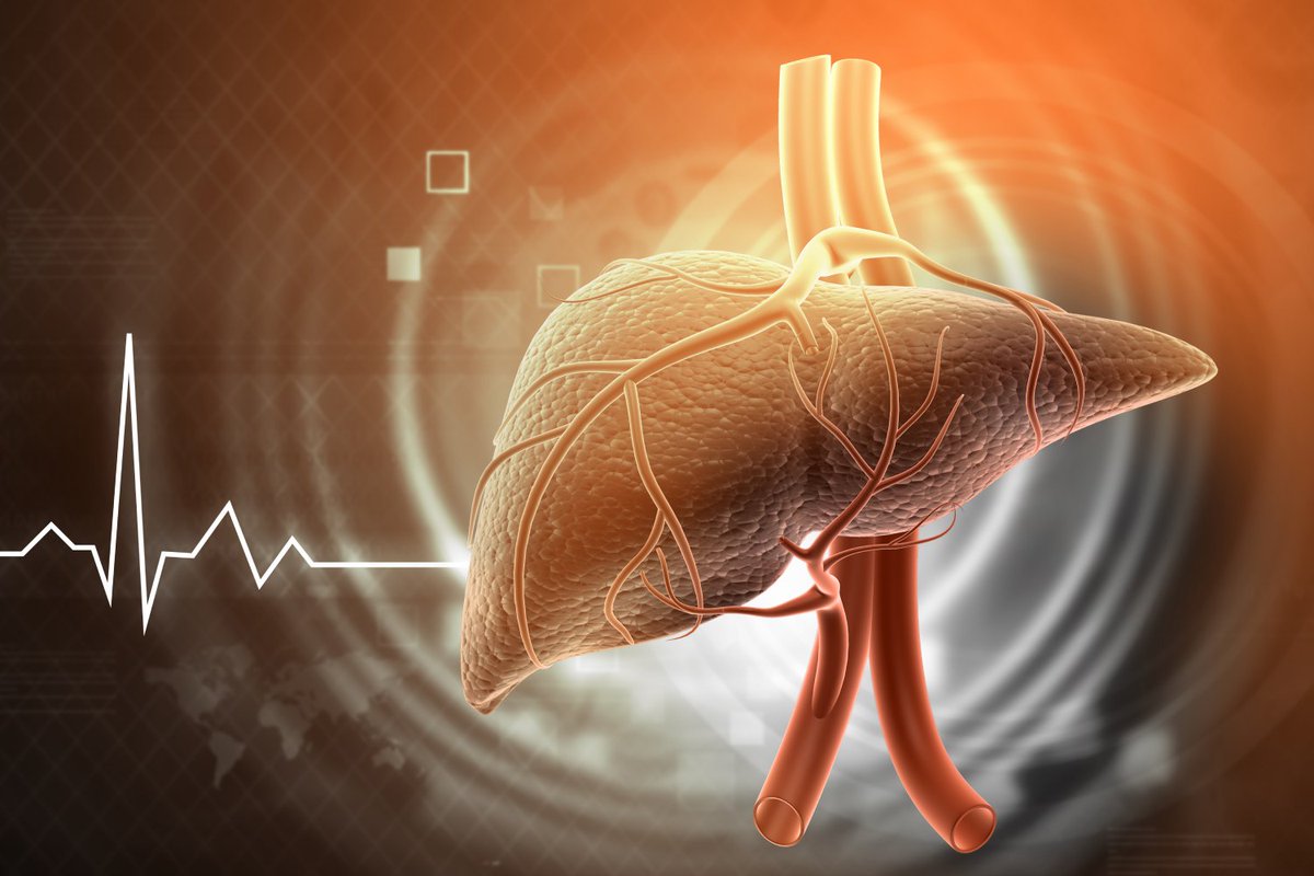 Cáncer de hígado: dos nuevas líneas de inmunoterapia amplían opciones terapéuticas. El limitado tratamiento del hepatocarcinoma y del cáncer de vías biliares cuenta ya con dos nuevos esquemas en primera línea, que han demostrado mejorar la supervivencia.➡️ n9.cl/p1b38