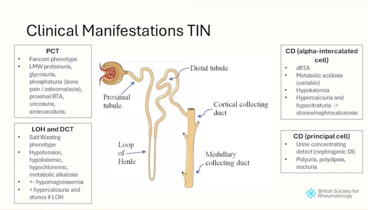 The clinical manifestations of Tubulointerstitial Nephritis in Primary #Sjogrens #Renal Proximal & Distal Tubule and Collecting duct (Alpha & Principal cells). Don’t miss it! 

[Dr Rhys Evans] #BSR24 

#Rheumatology #MedTwitter