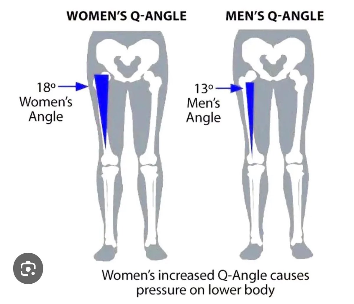 So besides never being able to reverse all advantage from male puberty the Q angle which effects cadence whilst running, cycling even kicking in swimming also increases knee injury by 3-6x in females. No males in female sport. It’s cheating & deliberate sex discrimination