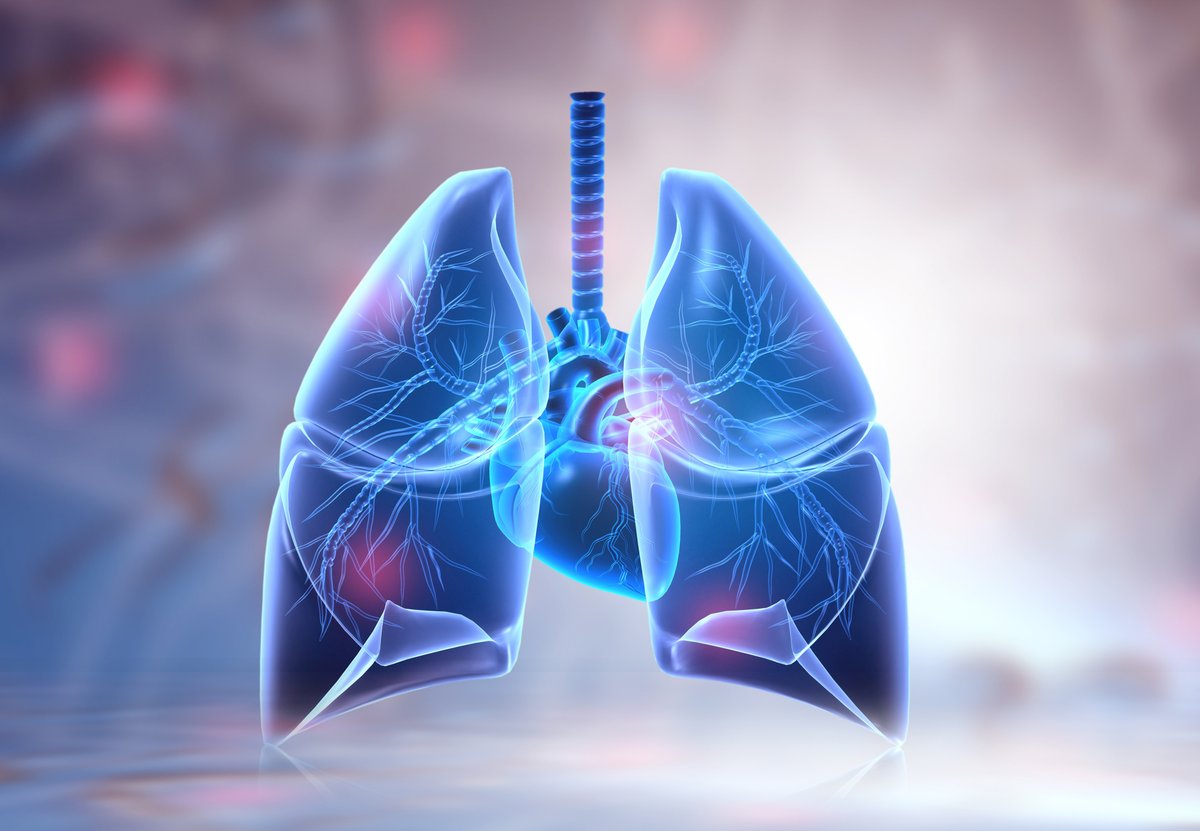 Does Thoracic Radiotherapy Induce Changes in Cardiac Morphology and Function? jnccn360.org/non-small-cell… #JNCCN360 #LCSM #nsclc