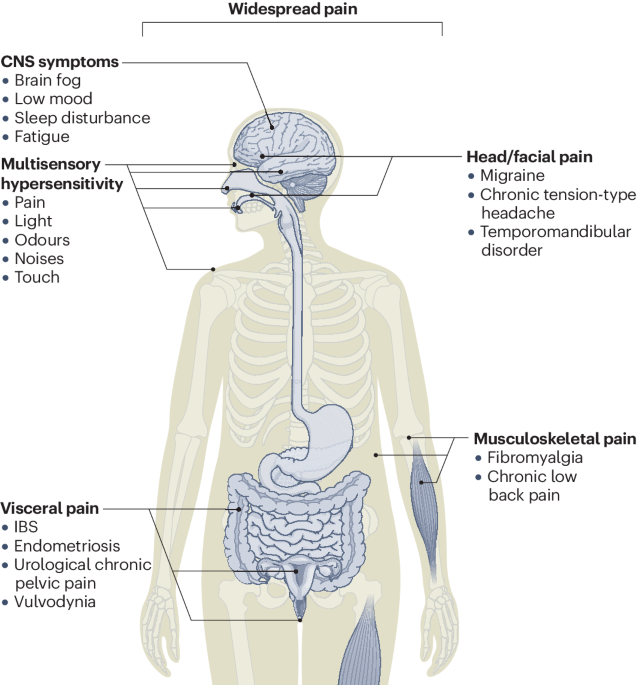 New online! Deciphering nociplastic pain: clinical features, risk factors and potential mechanisms go.nature.com/4bD7HV5