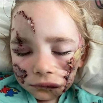 Prof. Dr. Ahmet Emin SEYHAN (@ahmeteminseyhan) on Twitter photo Çocuklar uyurken susulur.
Çocuklar başıboş köpekler yüzünden ölürken susulmaz, feryat edilir!
Nerede sizin empatiniz/duygudaşlığınız/eşduyum bilinciniz?
Sahiplenilmeyen köpekler uyutulmalıdır!
<a href="/RTErdogan/">Recep Tayyip Erdoğan</a> <a href="/TBMMresmi/">TBMM</a> <a href="/TC_icisleri/">T.C. İçişleri Bakanlığı</a> <a href="/AliYerlikaya/">Ali Yerlikaya</a> #KöpekTerörü <a href="/KopekSorunu/">Başıboş Köpek Sorunu - Stray Dog Problem</a> #kuduz Çocuklar uyurken susulur.
Çocuklar başıboş köpekler yüzünden ölürken susulmaz, feryat edilir!
Nerede sizin empatiniz/duygudaşlığınız/eşduyum bilinciniz?
Sahiplenilmeyen köpekler uyutulmalıdır!
<a href="/RTErdogan/">Recep Tayyip Erdoğan</a> <a href="/TBMMresmi/">TBMM</a> <a href="/TC_icisleri/">T.C. İçişleri Bakanlığı</a> <a href="/AliYerlikaya/">Ali Yerlikaya</a> #KöpekTerörü <a href="/KopekSorunu/">Başıboş Köpek Sorunu - Stray Dog Problem</a> #kuduz