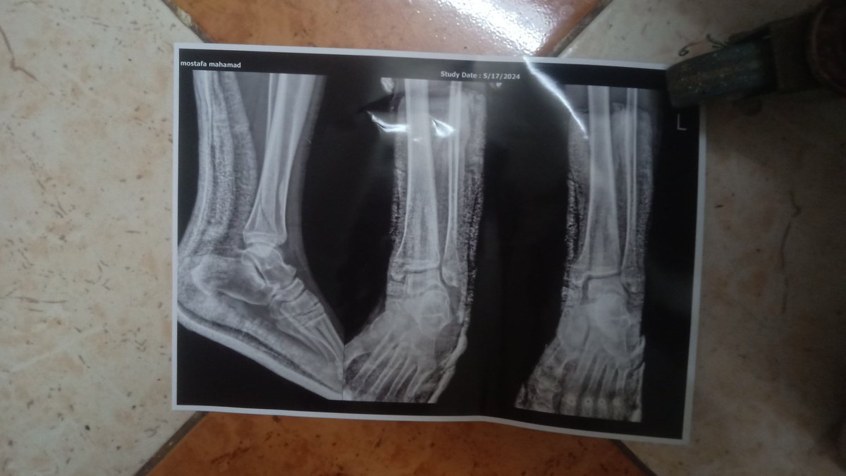 الحمد لله كسر مضاعف