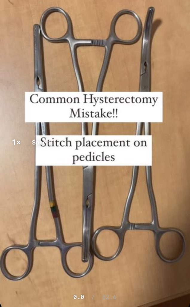 Common hysterectomy mistake! Jumping the clamp #operatingroom #surgeon #... youtu.be/obDzZS8v4jc?si… via @YouTube