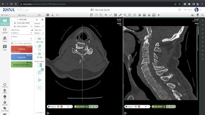 Radiology: Artificial Intelligence (@radiology_ai) on Twitter photo #AI competitions have engaged a global community to effectively address real-world medical problems doi.org/10.1148/ryai.2⦠<a href="/FelipeKitamura/">Felipe Kitamura</a> @slowvak <a href="/mattlungrenMD/">Matthew Lungren MD MPH</a> #DeepLearning #MachineLearning #competition #AI competitions have engaged a global community to effectively address real-world medical problems doi.org/10.1148/ryai.2⦠<a href="/FelipeKitamura/">Felipe Kitamura</a> @slowvak <a href="/mattlungrenMD/">Matthew Lungren MD MPH</a> #DeepLearning #MachineLearning #competition