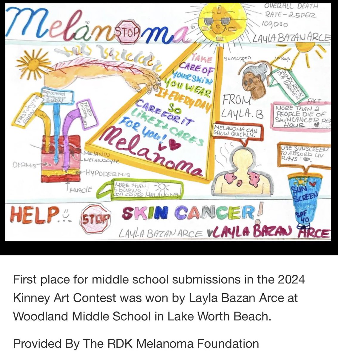 @WoodlandsMSAcad medical Ss competed in the Melanoma Foundation art contest and 6th grader, Layla Bazan-Arce won! We are so proud of her! Today the foundation rewarded her with a $2500 giftcard! @pbcsd @SDPBCJenKuras @jennsandersusa @southPbcsd @kaycehenning @RachelCapitano