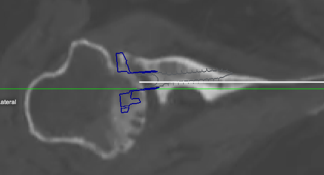 Tim Lenters, MD tweet media