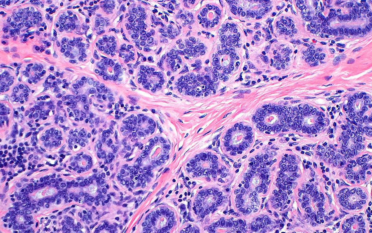 Benign Breast Lobules ~ #PathArt #BreastPath #Histology