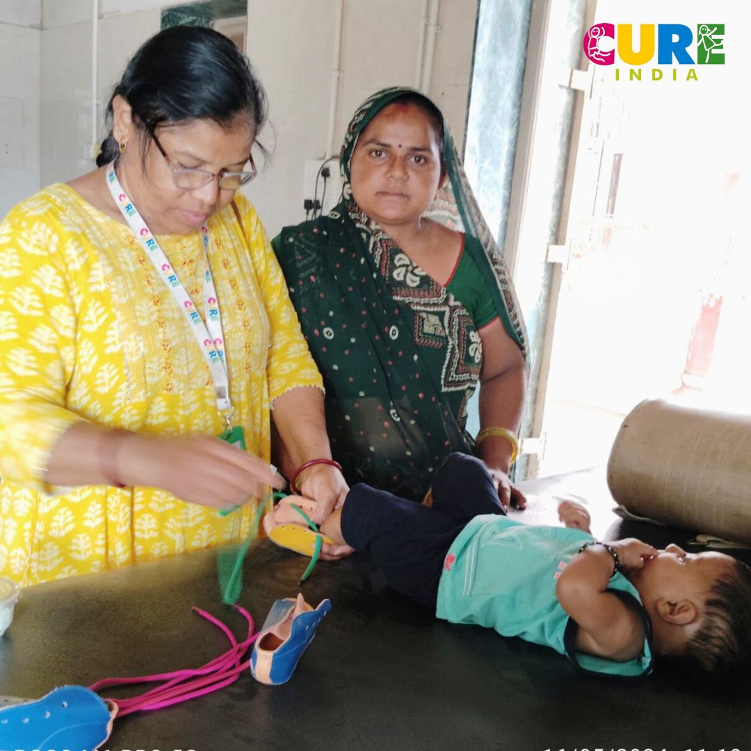 Our goal is to eliminate clubfoot disabilities across the nation, with a particular focus on the Morbi Clinic in Gujarat. We invite you to join us in supporting this vital mission.

#CUREforClubfoot #ComprehensiveCare #MorbiClinicFocus #EndClubfootDisabilities