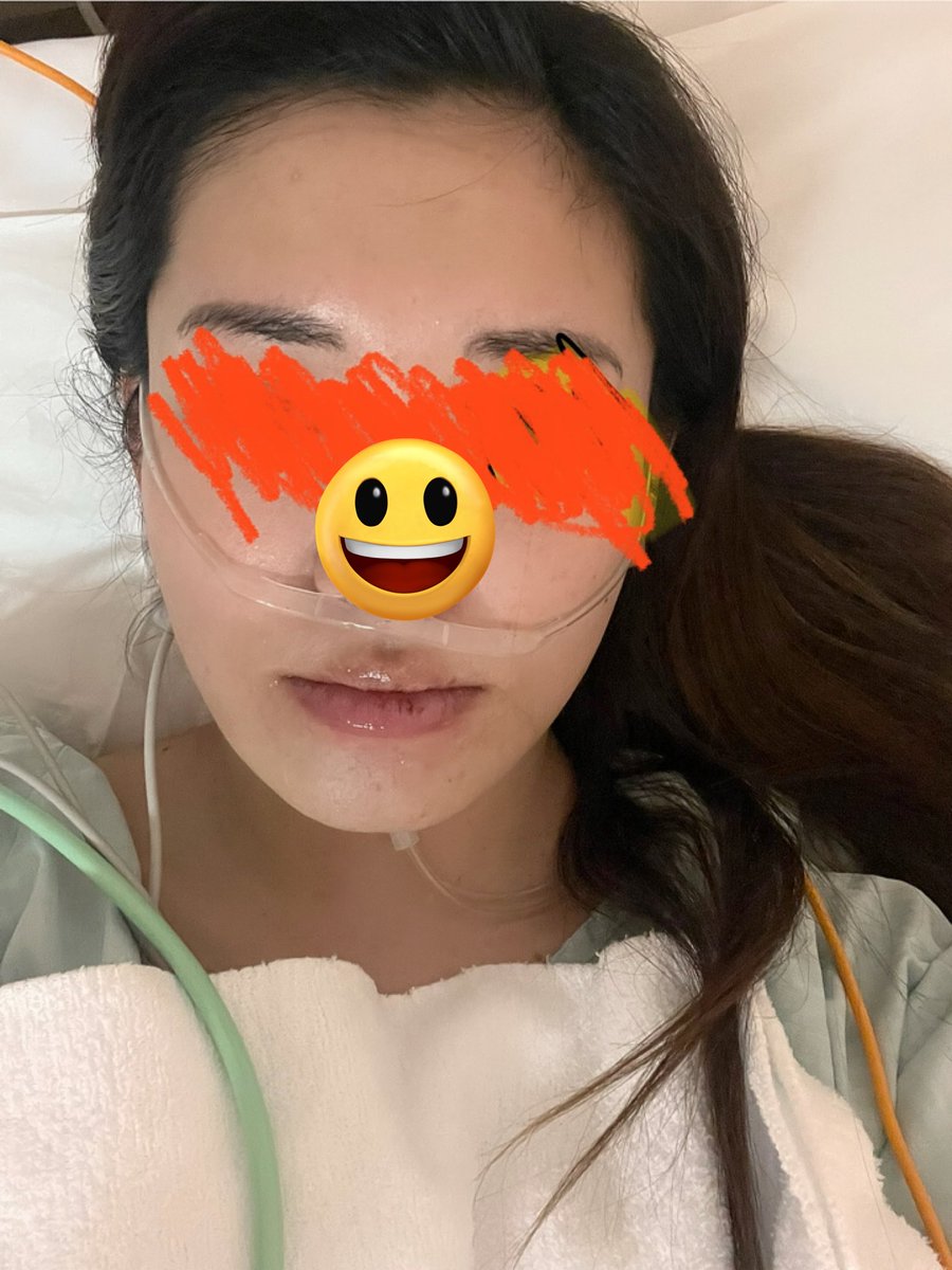 オペ終わった。まじ無理🥲
鎮静麻酔なんだけどわたし普通に意識あったww麻酔してるから何されてるかはわからんけど痛いとこは痛かった😂
痛い!これ本当に麻酔効いてます？麻酔増やせます？とかずっと言っててだるかっただろうな、、笑
今のところ腫れは下唇くらいかなぁー
普通に寝てたかった..