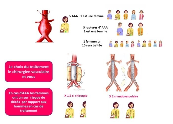 AAA FEMMES/HOMMES medvasc.info/archives-blog/… @LuciaMazzolai @VietHeartPA @pabeda1 @bbikdeli @NATFthrombosis @thrombosisday @ThrombosisCan @SCVE_fr @ahmedhatri2 @samevalgerie @BNacerra @SQuiquandon @Andali2020 @gilles2206 @gilles_dl @FLareyre @LareyreRaffort @Sonic_urticant @RespiFIL