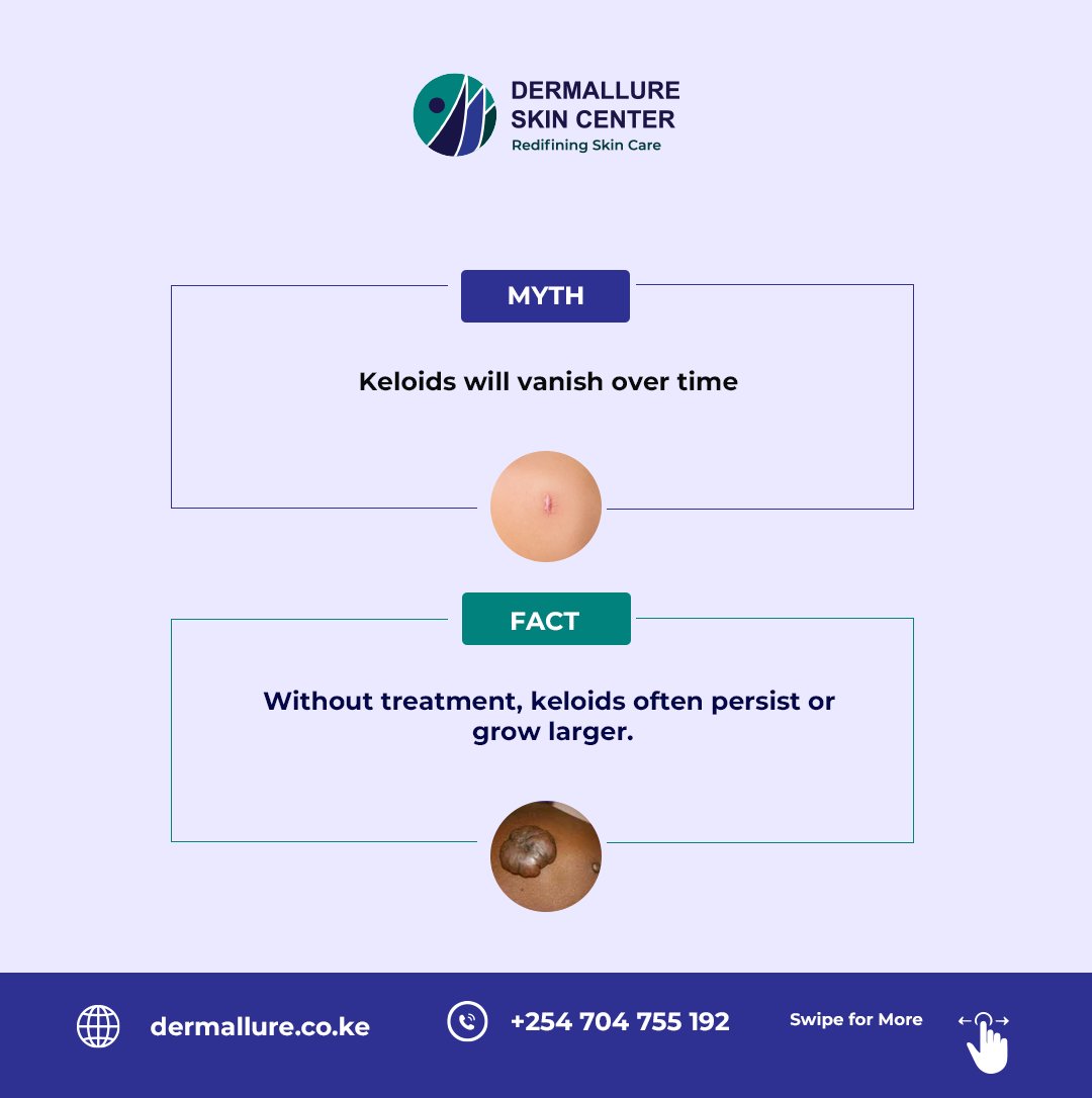 Clear up the confusion surrounding keloids! Stay informed and empowered. If keloids are affecting you, visit Dermallure Skin Center for expert removals. Contact us at +254 704 755 192 to book your appointment. #fypシ #KeloidAwareness #SkinHealth #DermallureSkinCenter