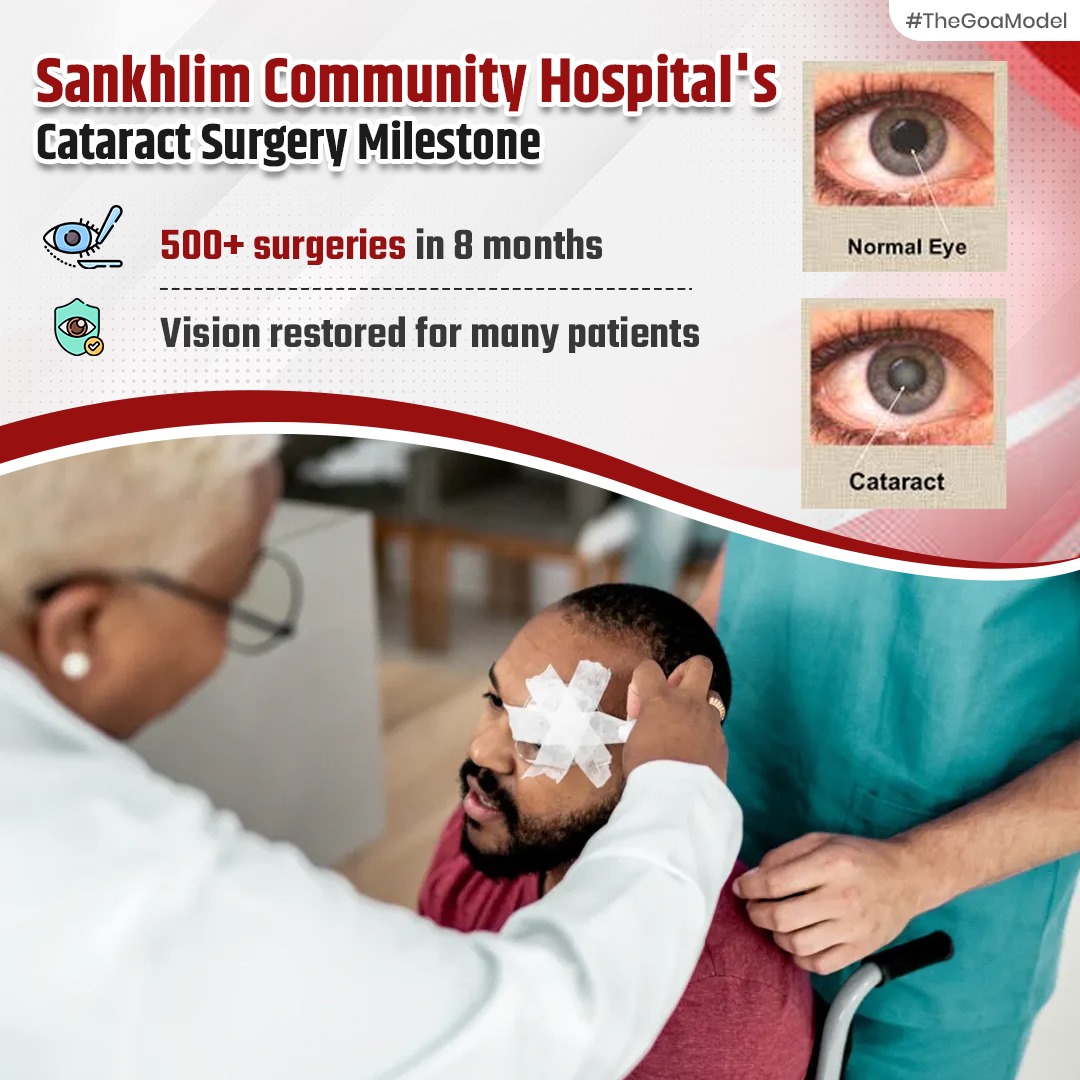 Sankhlim Community Hospital in Goa has performed over 500 cataract surgeries in just 8 months, restoring vision and improving lives. #TheGoaModel #HealthcareSuccess
#SankhlimCommunityHospital #CataractSurgeries  #ImprovingLives #HealthcareSuccess #GoaHealth #VisionRestoration