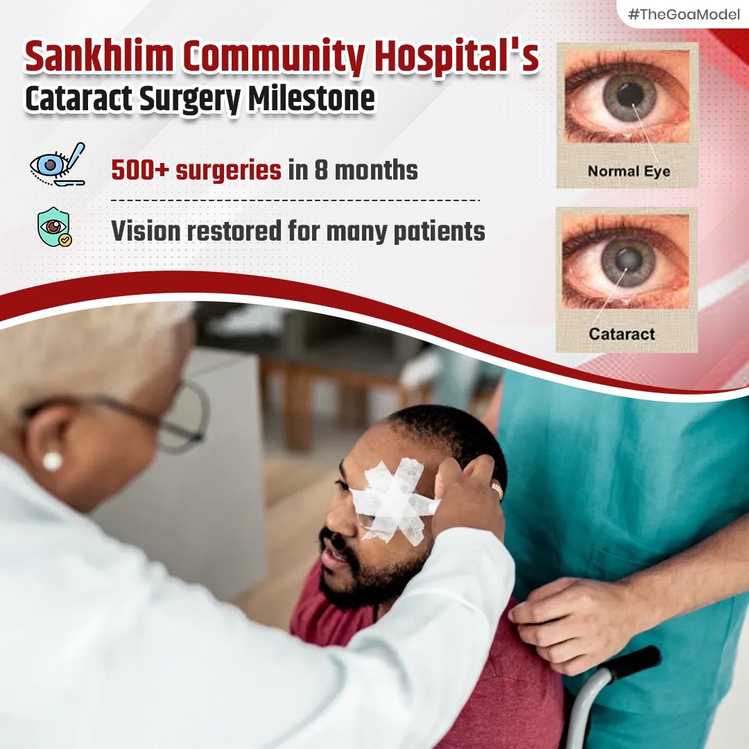 Sankhlim Community Hospital in Goa has performed over 500 cataract surgeries in just 8 months, restoring vision and improving lives. #TheGoaModel #HealthcareSuccess #SankhlimCommunityHospital #CataractSurgeries #ImprovingLives #HealthcareSuccess #GoaHealth #VisionRestoration