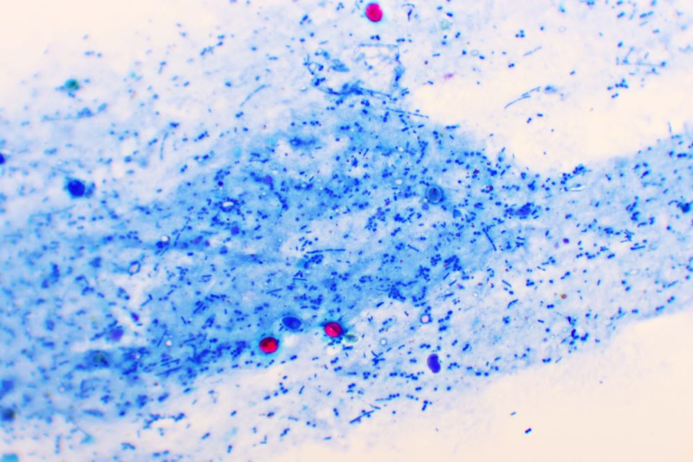 Cryptosporidium has been in the news this week, but it is possible to catch and spread it in a variety of ways. 💧🐑🥗 Read our guide to how to avoid #Crypto and what to do if you catch it ukhsa.blog.gov.uk/2024/05/17/wha…