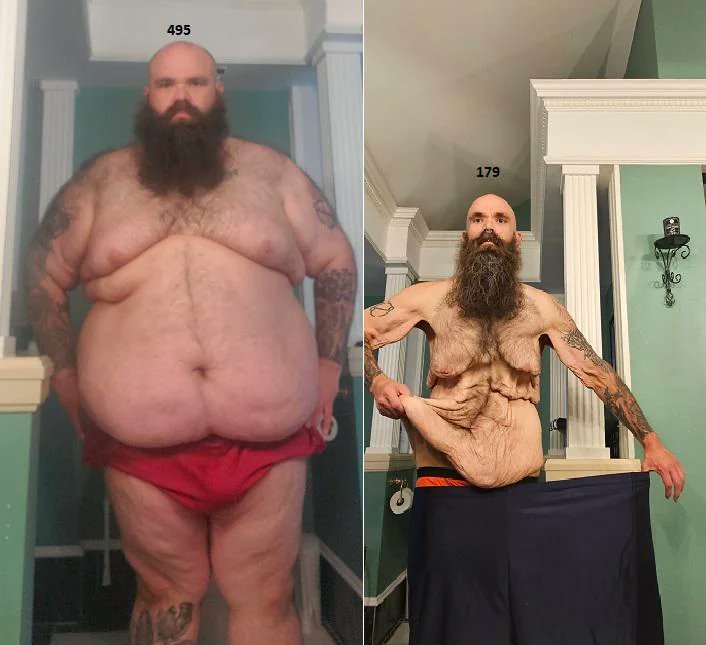 This is what 320lbs of weight loss over 2 years looks like