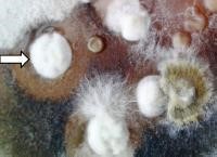 Neues #Antibiotikum, #Anthrotainin, zielt auf die Überwindung der #Antibiotikaresistenz von Prokaryoten (Archaeen, grampositive und gramnegative #Bakterien). Anthrotainin wirkt #antibakteriell gegen die derzeit wichtigsten resistenten Bakterien.

PDF unter transmit.de/exposes/pdf/12…