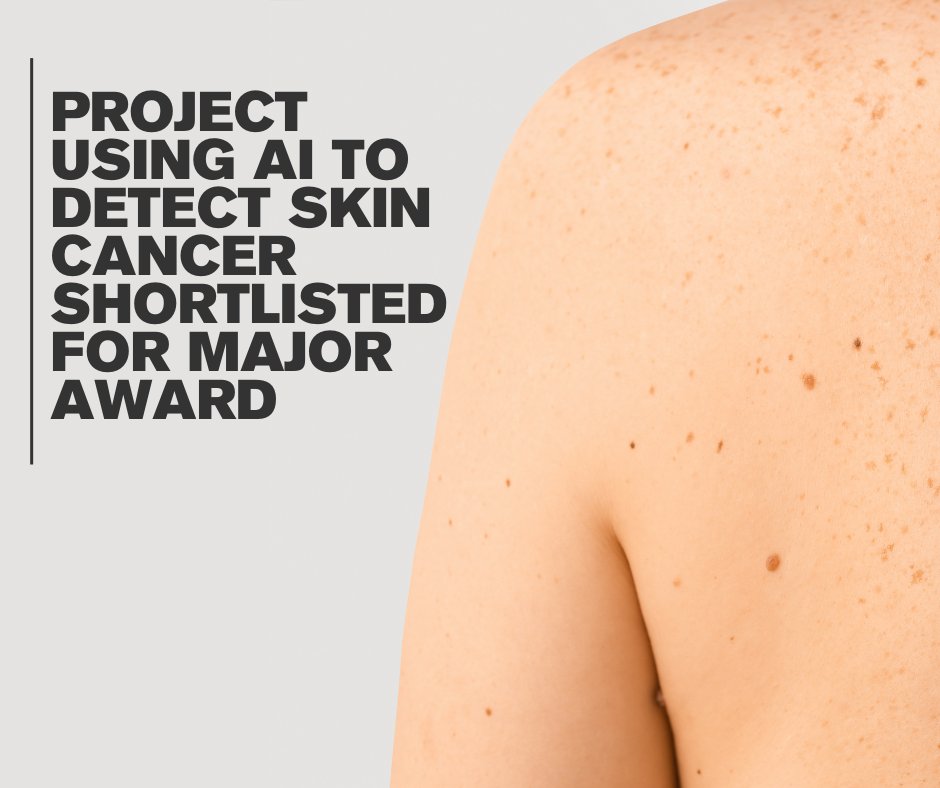 A pioneering project between Essex and @Check4Cancer has been shortlisted for a major @SEHTA_UK Award. @uni_essex_csee scientists are building an AI model which can analyse suspicious skin lesions and help detect all forms of skin cancer. brnw.ch/21wJRXT