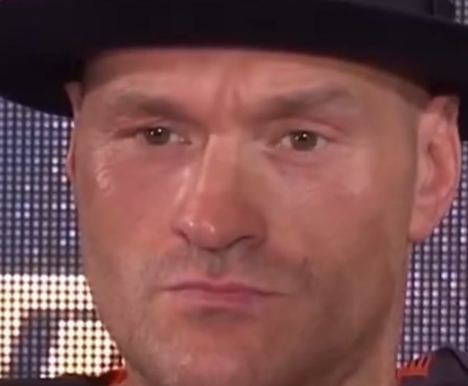 Tyson Fury’s eye’s look completely different from the cuts.