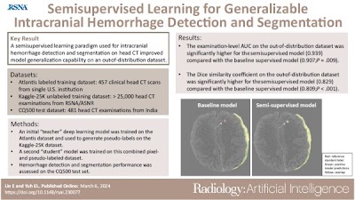 Semisupervised learning to detect intracranial hemorrhage doi.org/10.1148/ryai.2… @UCSFimaging #ICH #SSL #MachineLearning