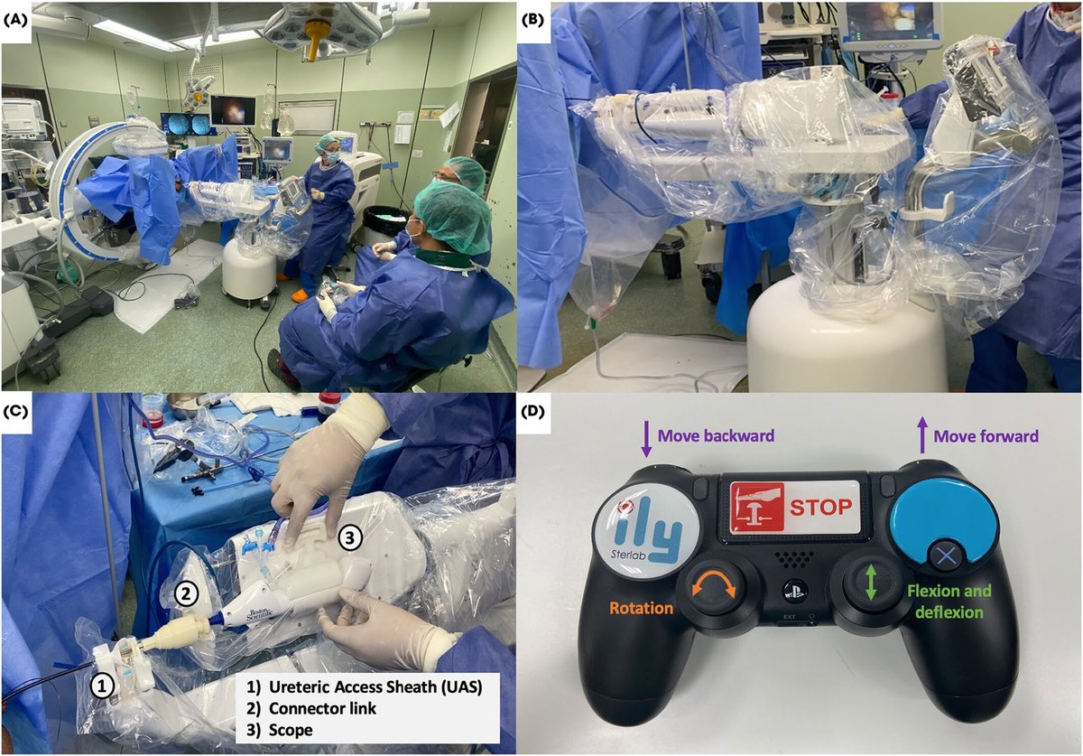 The first clinical experience with the novel ILY platform for #roboticRIRS to treat urinary stones at @FPuigvert @FarreAlf @emiliani_e doi.org/10.1111/bju.16…