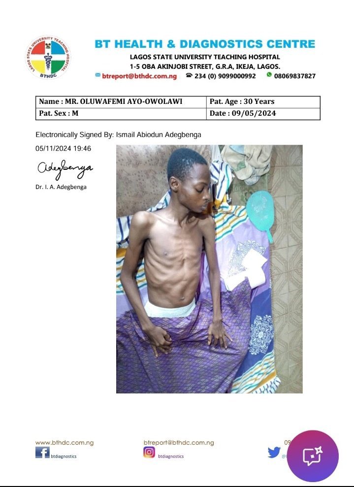 Please help save Oluwafemi Ayo-Owolawi, a graduate of OAU 🙏 He was diagnosed with renal cancer and will need urgent surgery and chemotherapy. Please help in any capacity you can, he needs N12million. Donate here: 0051980794 Fairmoney Ayo-Owolawi Oluwafemi