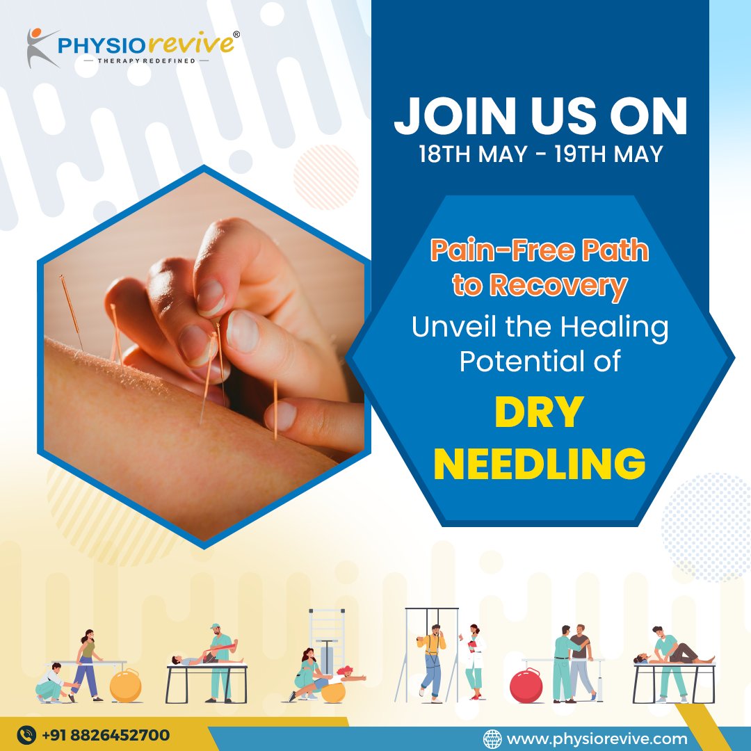 Join us on 18th May - 19th May for a pain-free path to recovery! Discover the healing potential of dry needling.
.
To book an appointment call us at - 088264 52700
Or visit us at: physiorevive.com
.
#DryNeedling #PainFreeRecovery #HealingJourney #PainRelief #Wellness