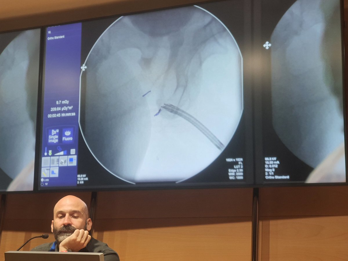 refaat abusamra (@refaatabusamra) on Twitter photo 2nd day of the amazing meeting <a href="/SurgeryIsFemale/">Surgery in the 3rd millennium:skills beyond gender</a> great surgeries with excellent (female) surgeons & fruitful discussion
If you attend it you will be addicted to it every year
Very nice comfortable & lovely atmosphere
Best luck every time dear <a href="/MariaJRibal/">Maria J. Ribal</a> <a href="/FrancoGaboardi/">Franco Gaboardi</a> 2nd day of the amazing meeting <a href="/SurgeryIsFemale/">Surgery in the 3rd millennium:skills beyond gender</a> great surgeries with excellent (female) surgeons & fruitful discussion
If you attend it you will be addicted to it every year
Very nice comfortable & lovely atmosphere
Best luck every time dear <a href="/MariaJRibal/">Maria J. Ribal</a> <a href="/FrancoGaboardi/">Franco Gaboardi</a>