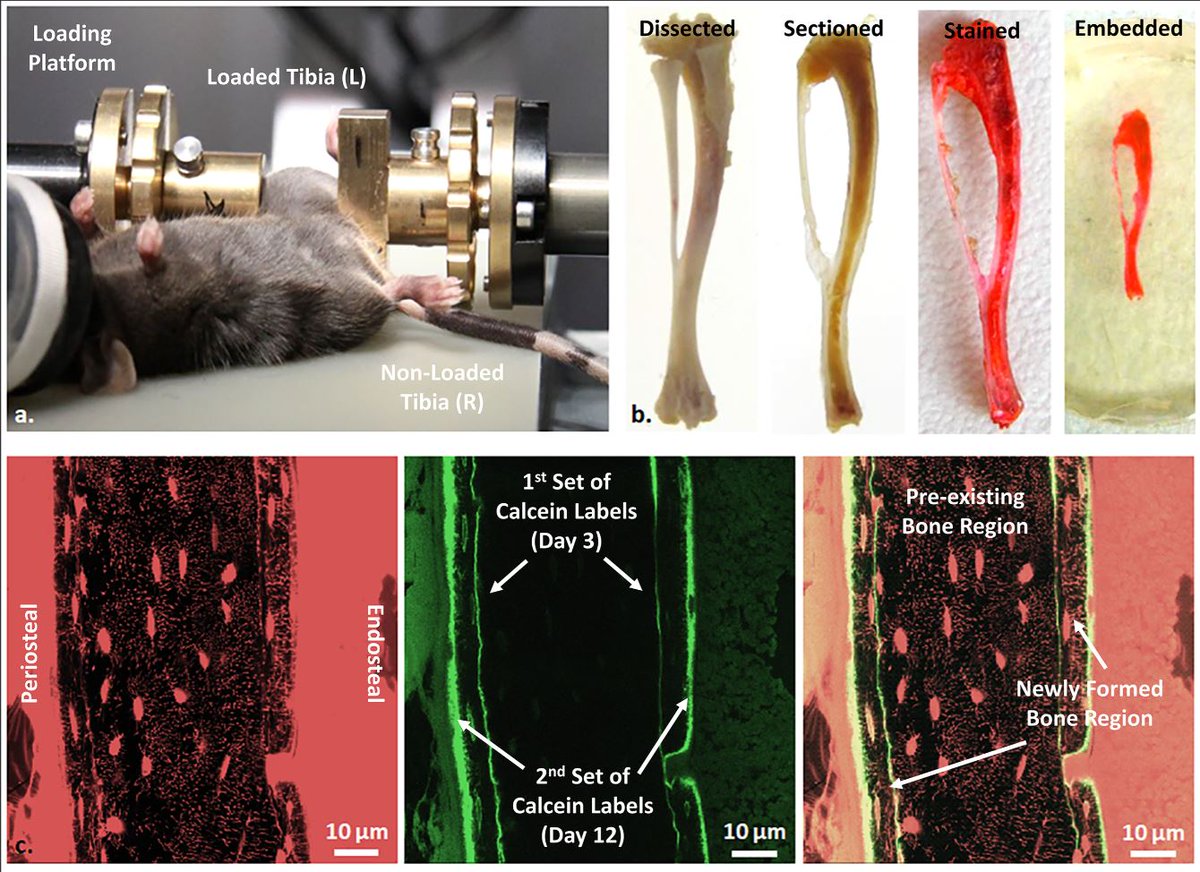 Junning Chen (@chen_junning) on Twitter photo Osteocyte lacuno-canalicular network (LCN) shows a strong spatial heterogeneity across cortex thickness, and densification of LCN maintains a tree-like structure but with increased shorter canaliculi. Thanks to my mentors, Ricci, Bettina, and <a href="/ARoschger/">Andreas Roschger</a>! dx.plos.org/10.1371/journa… Osteocyte lacuno-canalicular network (LCN) shows a strong spatial heterogeneity across cortex thickness, and densification of LCN maintains a tree-like structure but with increased shorter canaliculi. Thanks to my mentors, Ricci, Bettina, and <a href="/ARoschger/">Andreas Roschger</a>! dx.plos.org/10.1371/journa…