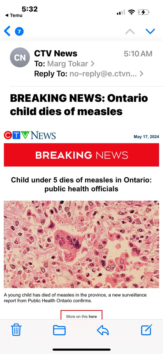PREVENTABLE These are the horrific consequences when parents are fed misinformation about vaccines. Children die. Ideological politicians have no right to dissemble medical information. FULL STOP.