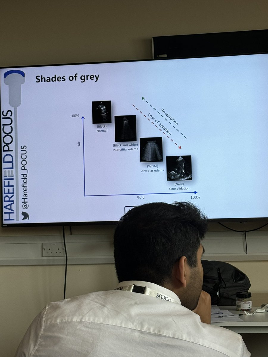James Pidding (@jamespidding) on Twitter photo Great day learning on the <a href="/Harefield_POCUS/">Harefield POCUS</a> accredited Lung Ultrasound course! Thank you <a href="/EchoSoliman/">Hatem Soliman, FRCP, FEACVI, FASE, FHEA</a> 🫁 🩺🩻 Great day learning on the <a href="/Harefield_POCUS/">Harefield POCUS</a> accredited Lung Ultrasound course! Thank you <a href="/EchoSoliman/">Hatem Soliman, FRCP, FEACVI, FASE, FHEA</a> 🫁 🩺🩻