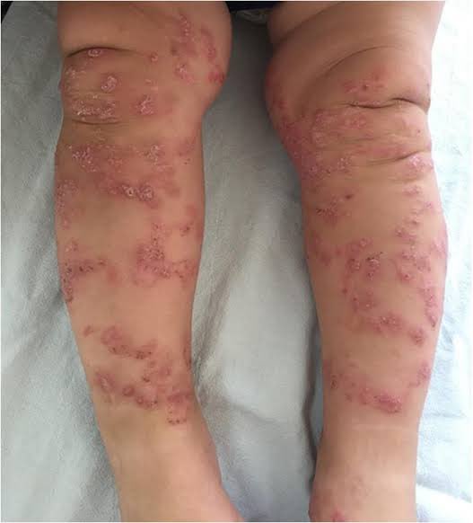 What is the diagnosis? Comment your answer