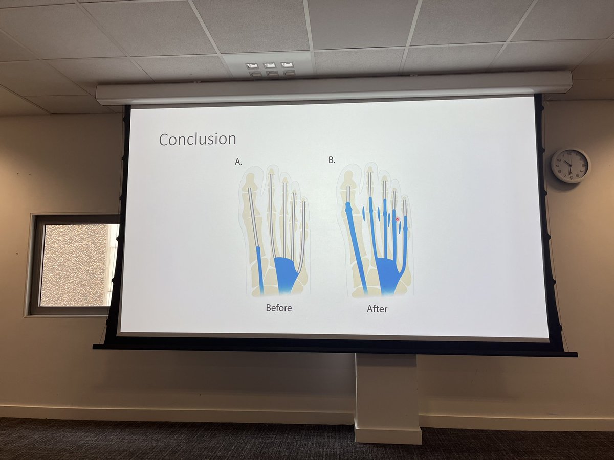 Lisa Wright (nee Newcombe) (@lnewco11) on Twitter photo A fabulous & inspiring talk from Dr Dakkak on forefoot bursitis & MRI imaging at <a href="/scotrheum/">Scottish Society for Rheumatology</a> Powerful message that anatomy textbooks fail to illustrate full length of tendon sheaths in the forefoot! ๐๐ฆถ๐ผwell done <a href="/MhairiBrandon/">Dr Mhairi Brandon FCSP</a> as chair! <a href="/MSKhealthGCU/">MSK Health GCU</a> <a href="/GCUultrasound/">GCU Ultrasound</a> <a href="/GCUPodiatry/">GCU Podiatry</a> A fabulous & inspiring talk from Dr Dakkak on forefoot bursitis & MRI imaging at <a href="/scotrheum/">Scottish Society for Rheumatology</a> Powerful message that anatomy textbooks fail to illustrate full length of tendon sheaths in the forefoot! ๐๐ฆถ๐ผwell done <a href="/MhairiBrandon/">Dr Mhairi Brandon FCSP</a> as chair! <a href="/MSKhealthGCU/">MSK Health GCU</a> <a href="/GCUultrasound/">GCU Ultrasound</a> <a href="/GCUPodiatry/">GCU Podiatry</a>
