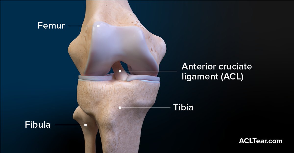 Suffering from a torn ACL? Learn more about ACL injuries and the treatment options available: arthrex.info/4dAX5b0 #Arthrex #Orthopedics #MedicalEducation #ACLTear #Knee #ACLInjury
