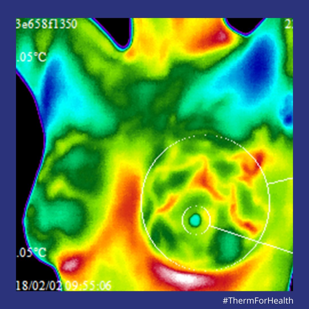 No radiation, no pain, and no body contact.
Thermography is a better way to scan your body for health!

Call Our Office to Schedule Your Scan: 212-838-8884

#thermforhealth #thermographynyc #clinicalthermography #noradiation #earlydetectionsaveslives